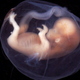 Image for article titled New photographs reveal that fetuses yawn in the womb